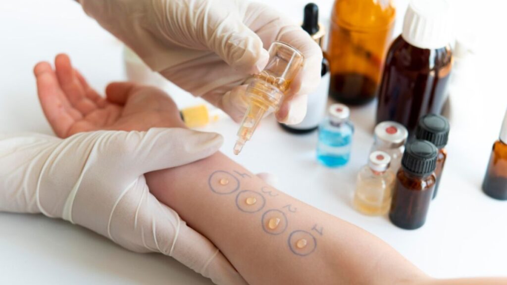 Exploring the Role of Betametacron in Allergy Management